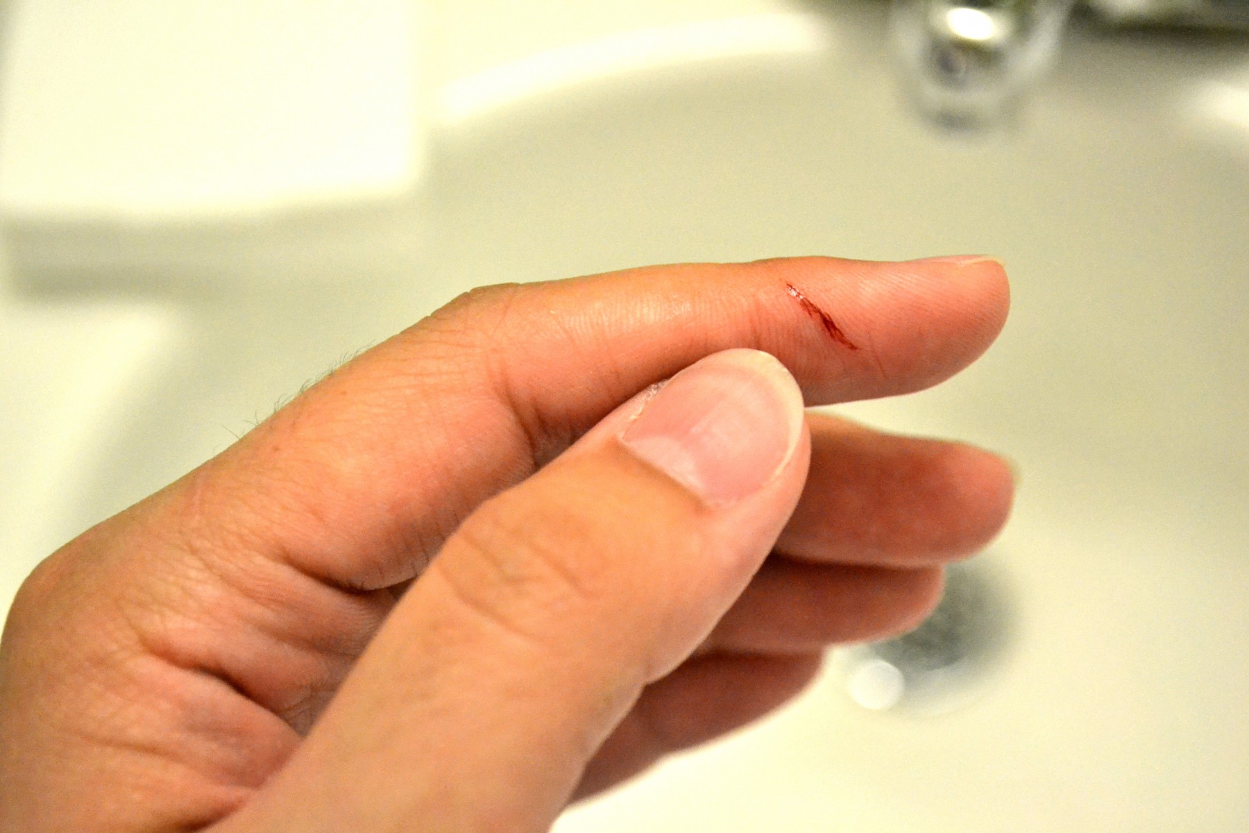 employee cut fingers on jobsite report to osha